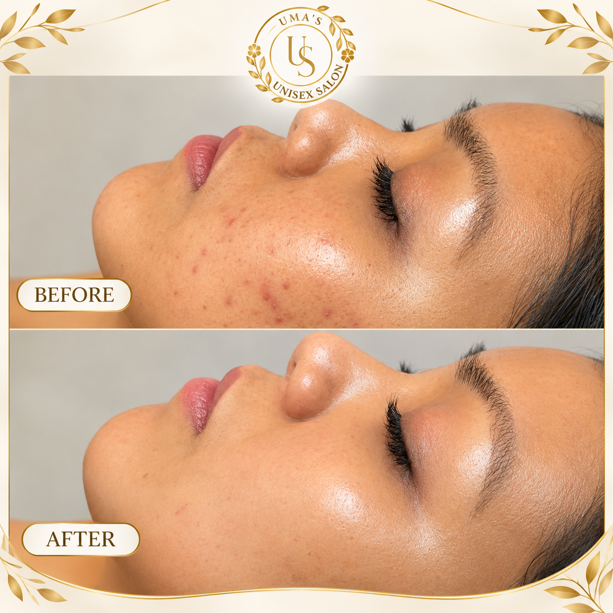 Elegant Salon Skincare in Udaipur