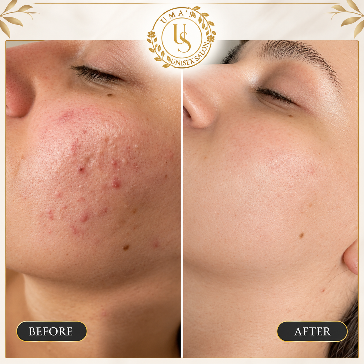 Uma’s Salon Skincare Transformation